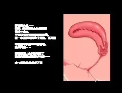 【PC/精翻/无码/触手/调教/巨乳】淫界人柱阿拉卡1.0.0 [1+2.0g][百度盘]